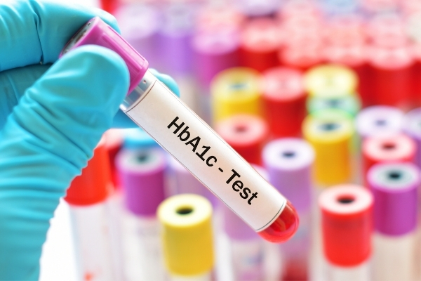 نصائح لتقليل نسبة HbA1c
