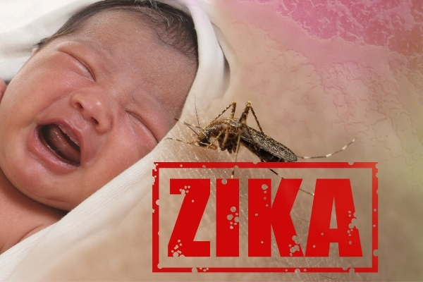 الوقاية من فيروس زيكا