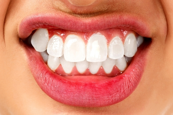 أسباب الجز على الأسنان