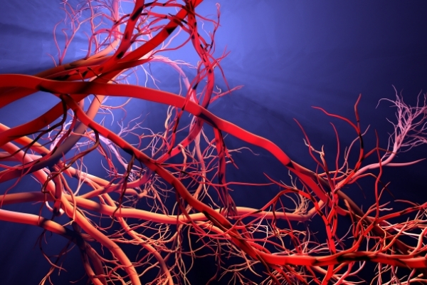 أنواع تمدد الأوعية الدموية