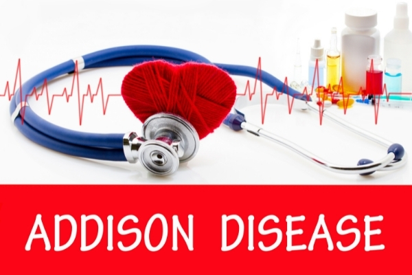 ما هو مرض اديسون
